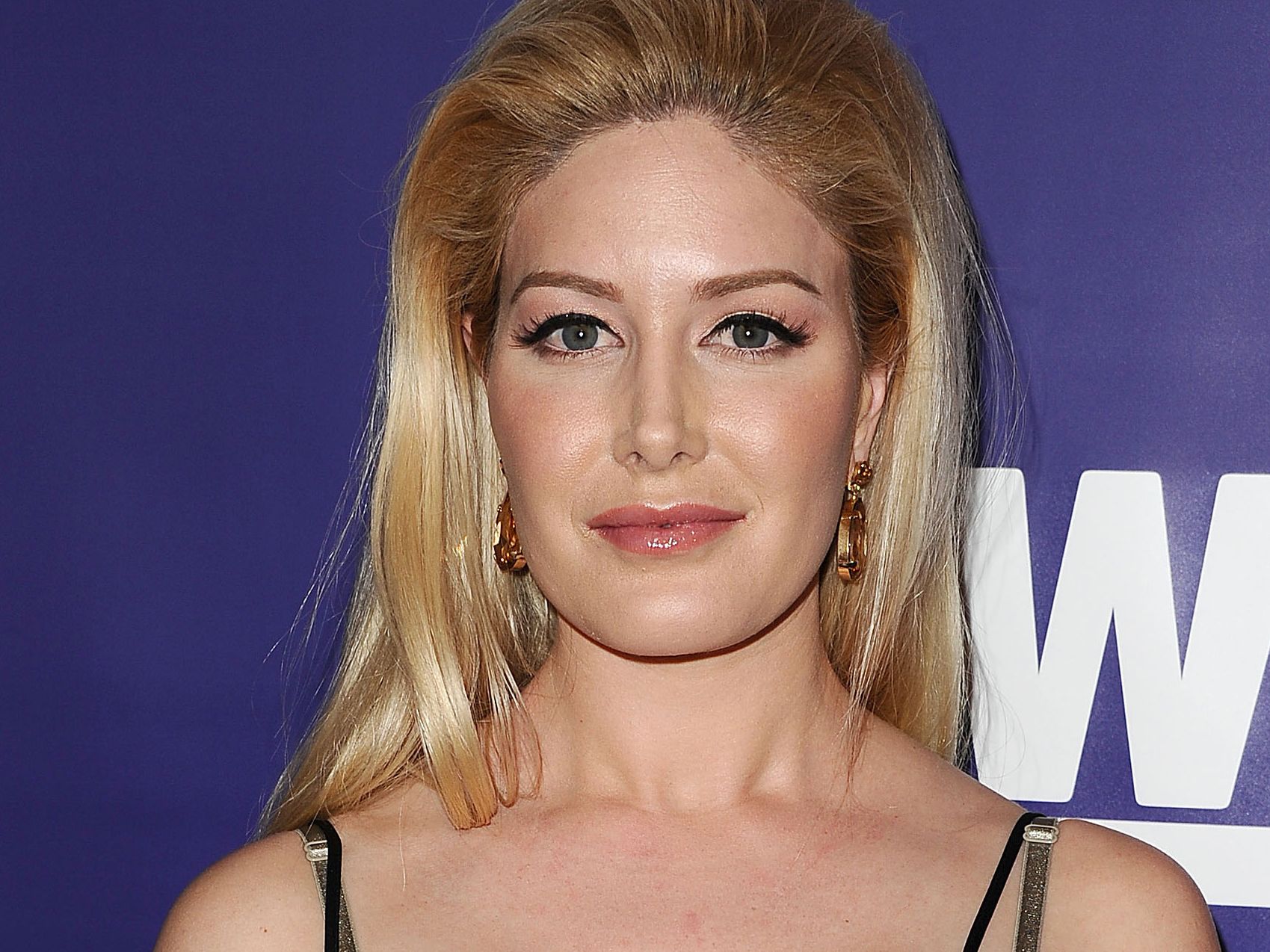 heidi montag admits to dying during cosmetic surgery - Fans Joji™ Store